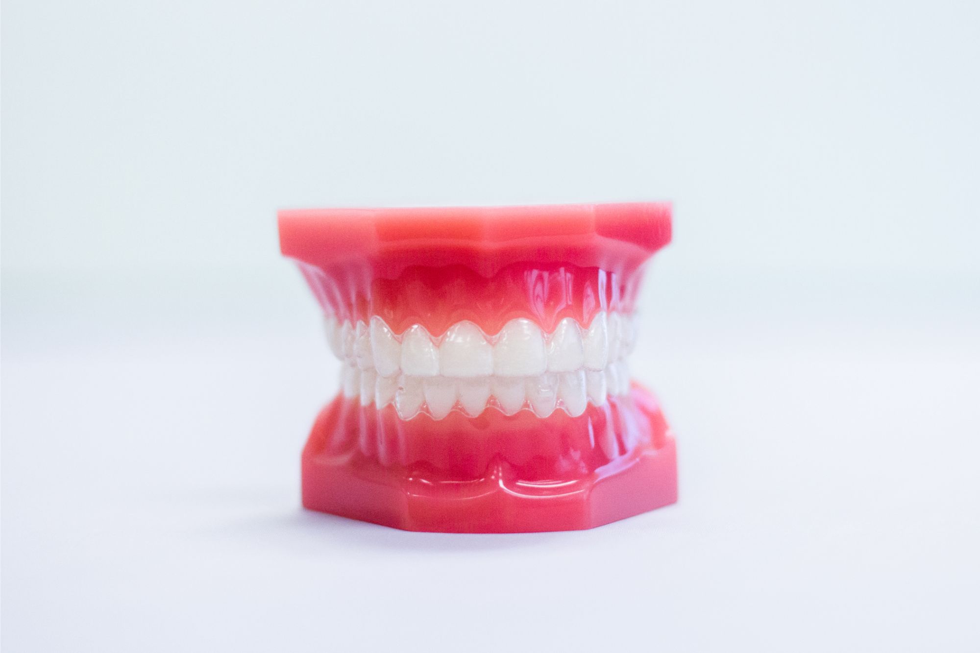 invisalign aligners on plastic model