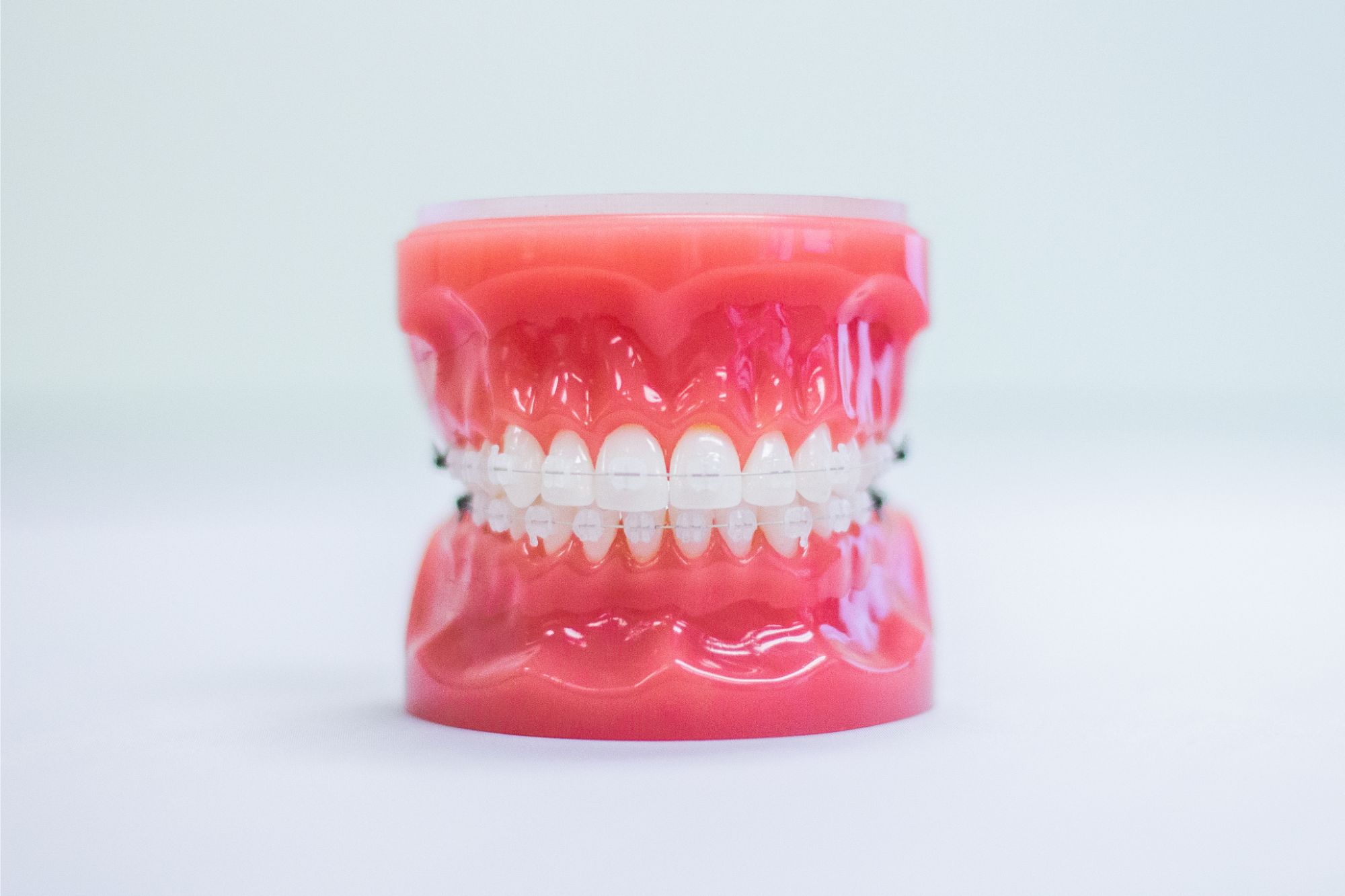 clear braces on plastic model